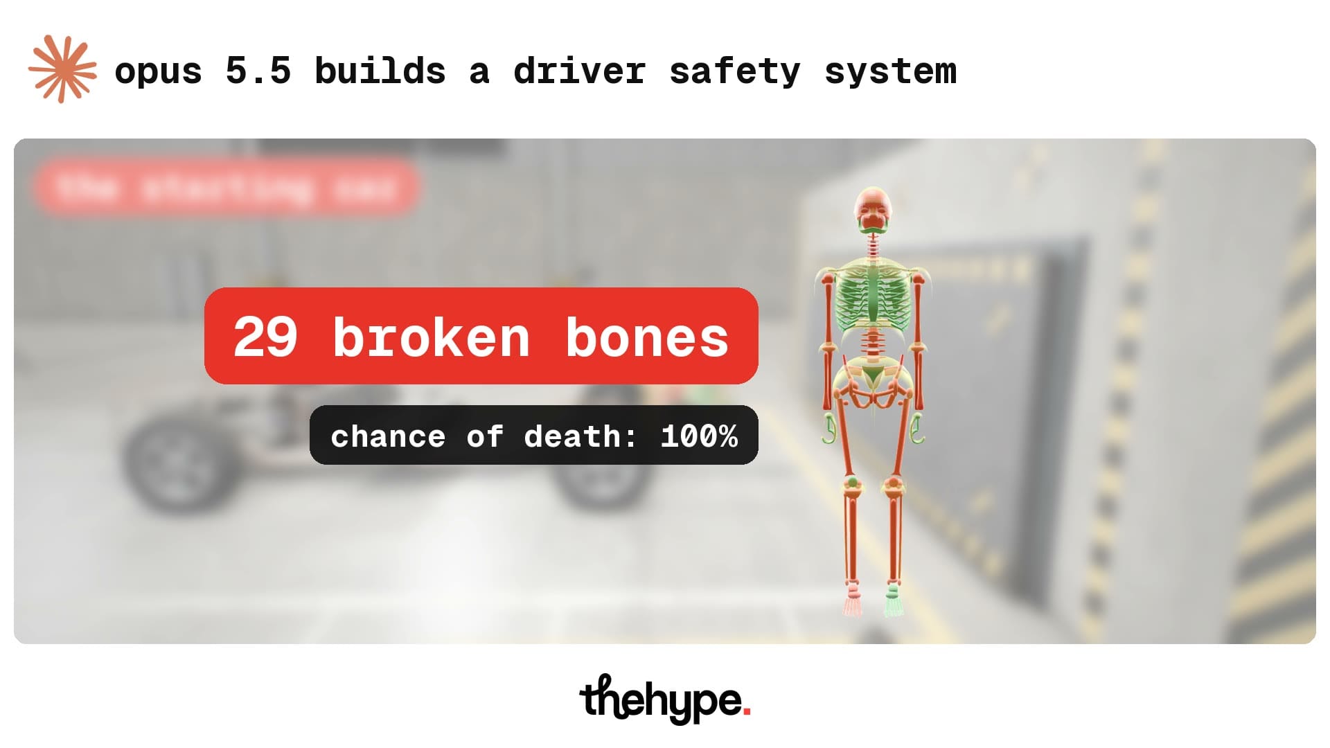 Result card after the first crash: 29 broken bones, chance of death 100%, next to a skeleton with red broken bones